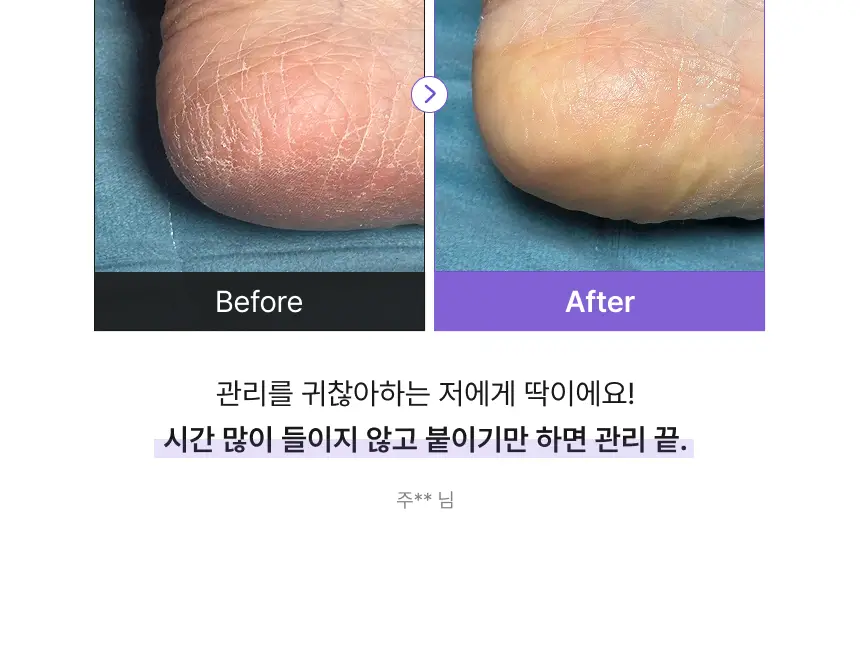 [특별한정/1위 버터패치] 바렌 시어버터 슬리핑 힐 패치 6매입 기획 (+미니풋파일) 상세페이지 13